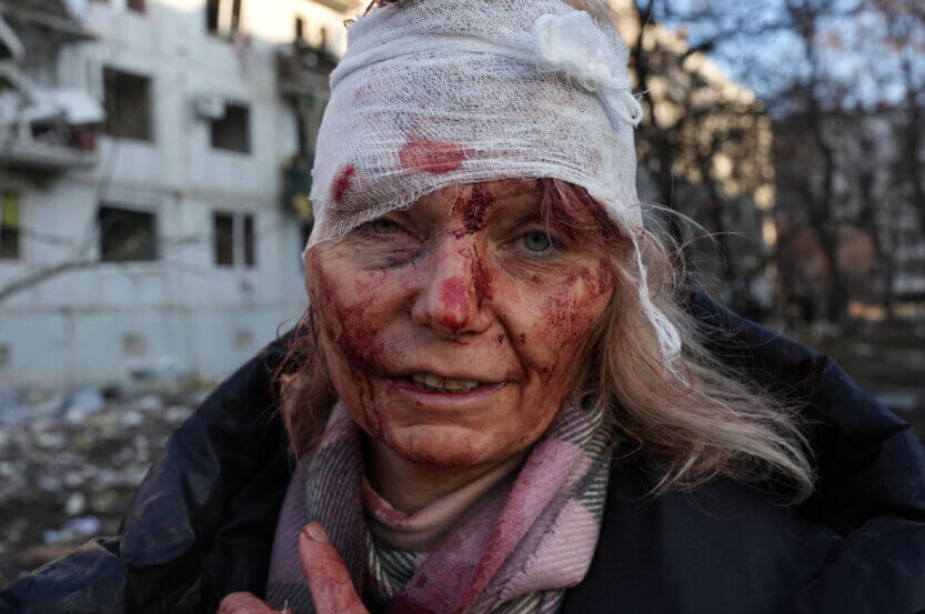 Wolfgang Schwan's photo of a Ukraine war victim spurred Zhenya Gershman to paint "First Face of War."